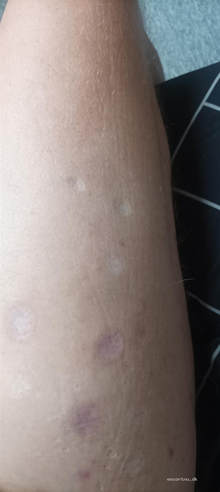 Transvisit